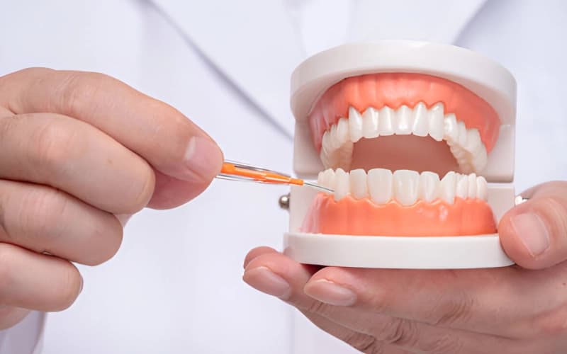 Prikaz pravilne upotrebe interdentalne četkice za čišćenje zuba